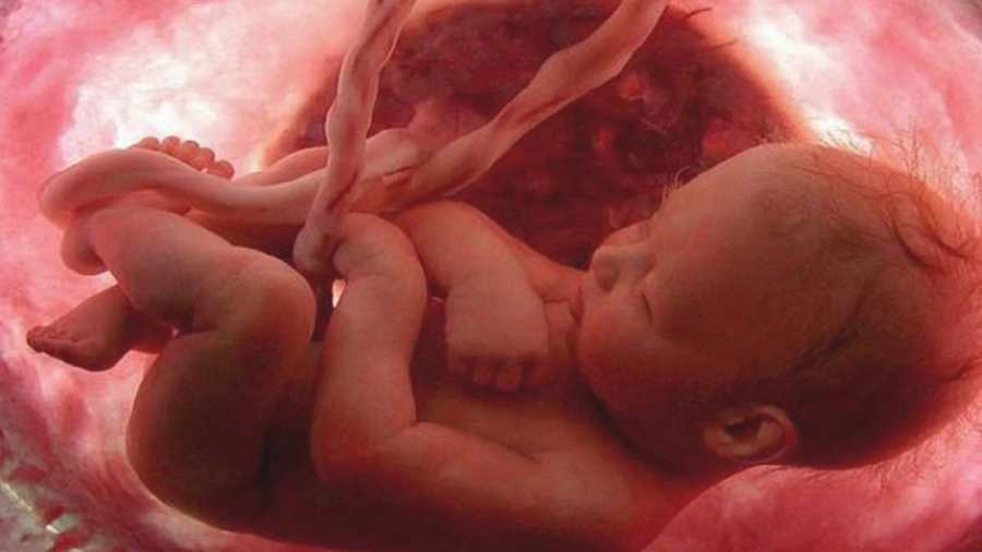 Védőbeszéd – „ahol az abortusz engedélyezett, ott nincs jogállamiság!”